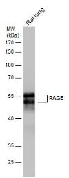 Anti-RAGE antibody used in Western Blot (WB). GTX23611