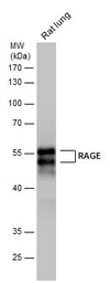Anti-RAGE antibody used in Western Blot (WB). GTX23611