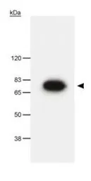 Anti-Pescadillo antibody used in Western Blot (WB). GTX23626