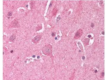 Anti-LDB2 antibody used in IHC (Paraffin sections) (IHC-P). GTX23627
