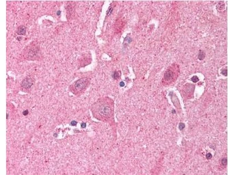 Anti-LDB2 antibody used in IHC (Paraffin sections) (IHC-P). GTX23627