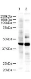 Anti-LDB2 antibody used in Western Blot (WB). GTX23627