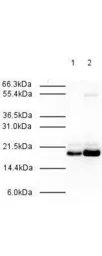 Anti-MAD2L2 antibody used in Western Blot (WB). GTX23630