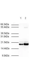 Anti-MAD2L2 antibody used in Western Blot (WB). GTX23630
