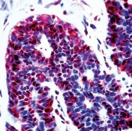 Anti-CDKN2A / p14ARF antibody used in Immunohistochemistry (IHC). GTX23642
