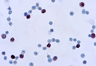 Anti-Adenovirus antibody [M58 + M73] used in Immunocytochemistry/ Immunofluorescence (ICC/IF). GTX23648