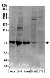 Anti-MCM7 antibody used in Western Blot (WB). GTX23732