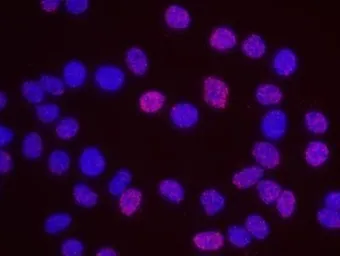 Anti-MCM7 antibody used in Proximity ligation assay (PLA). GTX23732