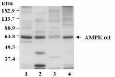 Anti-AMPK alpha 1 antibody used in Western Blot (WB). GTX23759