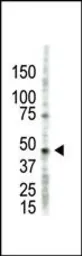 Anti-PRMT2 antibody used in Western Blot (WB). GTX23763