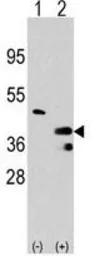 Anti-PRMT1 antibody used in Western Blot (WB). GTX23768