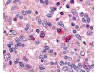 Anti-Artemis antibody used in IHC (Paraffin sections) (IHC-P). GTX23834