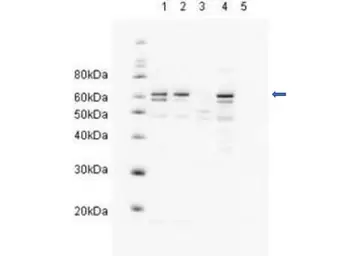Anti-RAD23A antibody used in Western Blot (WB). GTX23836