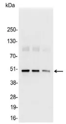 Anti-KT3 tag antibody used in Western Blot (WB). GTX23859