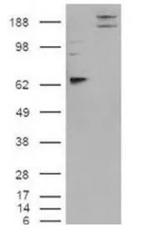 Anti-SynCAM antibody used in Western Blot (WB). GTX23910