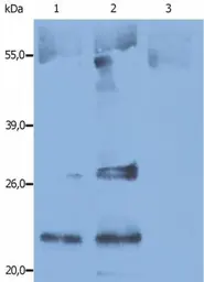 Anti-CD9 antibody [IVA50] used in Western Blot (WB). GTX23923