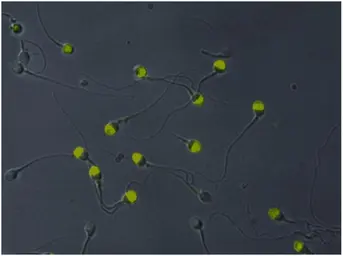Anti-VCP antibody [Hs-14] used in Immunocytochemistry/ Immunofluorescence (ICC/IF). GTX23983