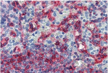 Anti-HLA-E antibody [MEM-E/06] used in IHC (Paraffin sections) (IHC-P). GTX23984