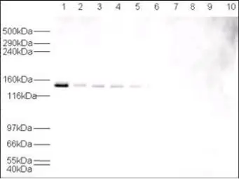 Anti-USP7 antibody used in Western Blot (WB). GTX24080