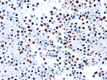Anti-KSHV antibody [LN35] used in Immunocytochemistry/ Immunofluorescence (ICC/IF). GTX24103