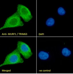 Anti-MURF1 antibody used in Immunocytochemistry/ Immunofluorescence (ICC/IF). GTX24125