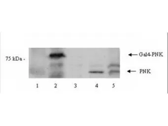 Anti-PNK antibody used in Western Blot (WB). GTX24191