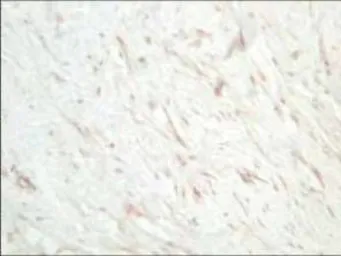 Anti-SFRP1 antibody used in Immunohistochemistry (IHC). GTX24193