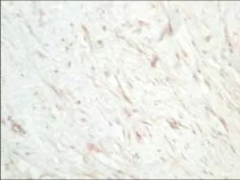Anti-SFRP1 antibody used in IHC (Paraffin sections) (IHC-P). GTX24193