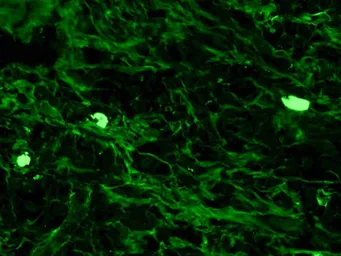 Rabbit Anti-Human IgG antibody (FITC). GTX24220