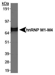 Anti-hnRNP M1-M4 antibody [3C181] used in Western Blot (WB). GTX24268