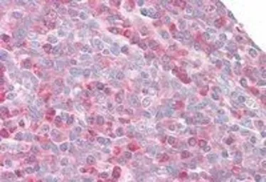 Anti-MPS1 antibody used in IHC (Paraffin sections) (IHC-P). GTX24385