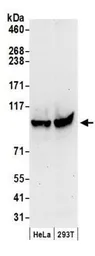 Anti-MCM3 antibody used in Western Blot (WB). GTX24460