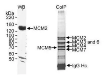 Anti-MCM2 antibody used in Immunoprecipitation (IP). GTX24461