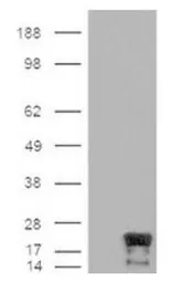 Anti-Survivin antibody [60.11] used in Western Blot (WB). GTX24470