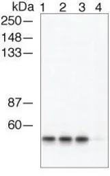 Anti-beta Arrestin 1 (phospho Ser412) antibody used in Western Blot (WB). GTX24472