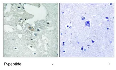 Anti-BLNK (phospho Tyr84) antibody used in IHC (Paraffin sections) (IHC-P). GTX24474