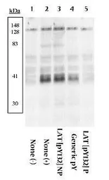 Anti-LAT (phospho Tyr132) antibody used in Western Blot (WB). GTX24476