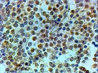 Anti-TRIP antibody, C-term used in IHC (Paraffin sections) (IHC-P). GTX24533