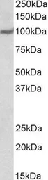 Anti-USP4 antibody, N-term used in Western Blot (WB). GTX24546