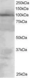 Anti-VAV2 antibody, Internal used in Western Blot (WB). GTX24549