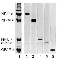 Anti-NF-L antibody [DA2] used in Western Blot (WB). GTX24572