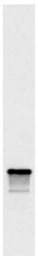Anti-Nop1p antibody [28F2] used in Western Blot (WB). GTX24575