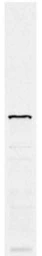Anti-Nop5p + Nop58p antibody [34B12] used in Western Blot (WB). GTX24639