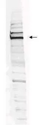 Anti-WHIP antibody used in Western Blot (WB). GTX24731