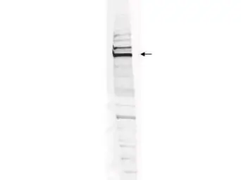 Anti-WHIP antibody used in Western Blot (WB). GTX24731