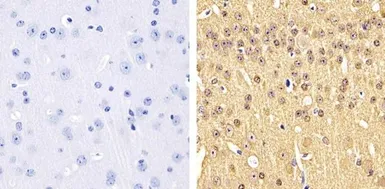 Anti-Tau (phospho Ser199) antibody used in IHC (Paraffin sections) (IHC-P). GTX24749