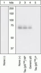 Anti-Tau (phospho Ser199) antibody used in Western Blot (WB). GTX24749