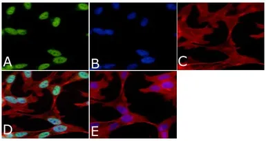 Anti-Tau (phospho Ser199) antibody used in Immunocytochemistry/ Immunofluorescence (ICC/IF). GTX24749