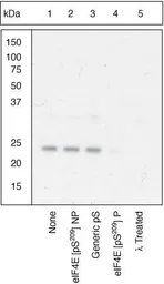 Anti-eIF4E (phospho Ser209) antibody used in Western Blot (WB). GTX24774
