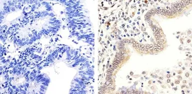 Anti-Rb (phospho Thr826) antibody used in IHC (Paraffin sections) (IHC-P). GTX24779